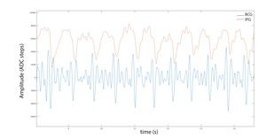 Die Pulswellengeschwindigkeit wird durch minimale Gewichtsverlagerungen und elektrische Impulse ermittelt. (Quelle: Withings)